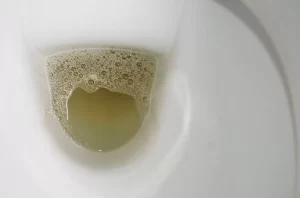Urine Berbusa