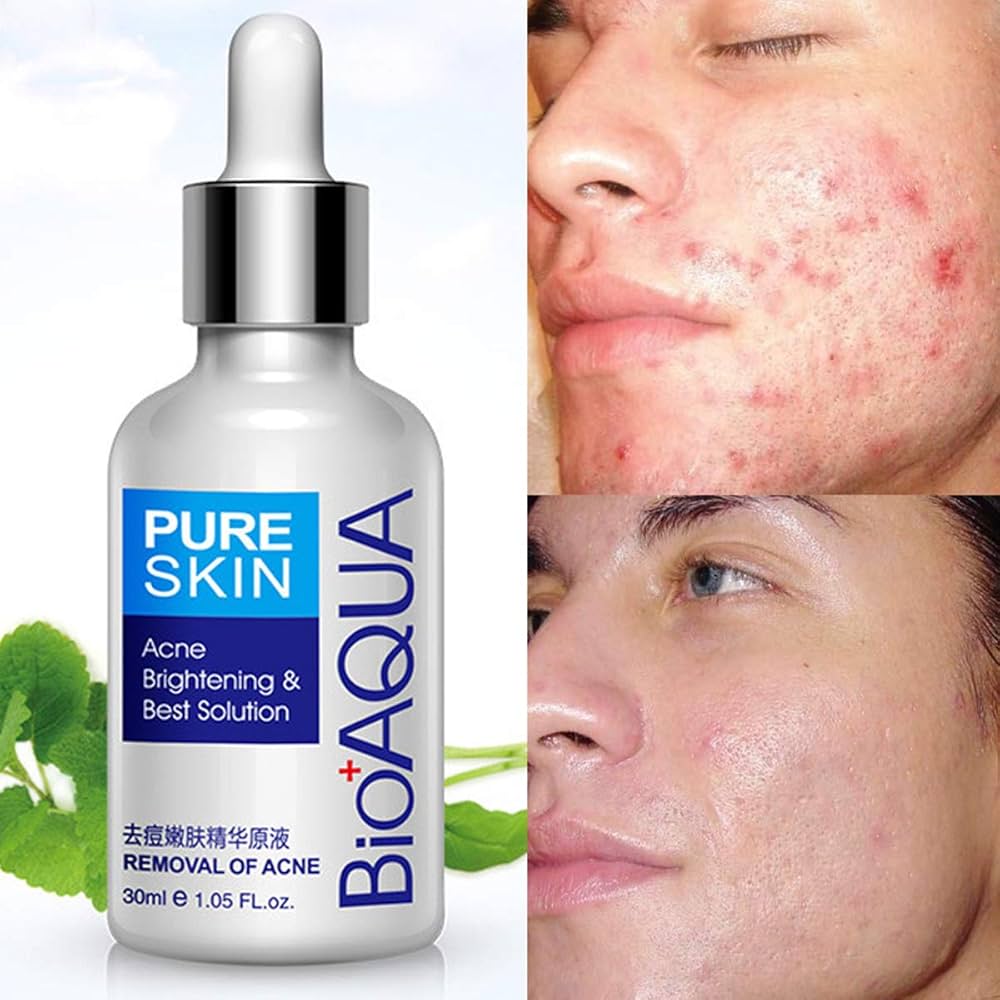 Bioaqua Pure Skin Serum