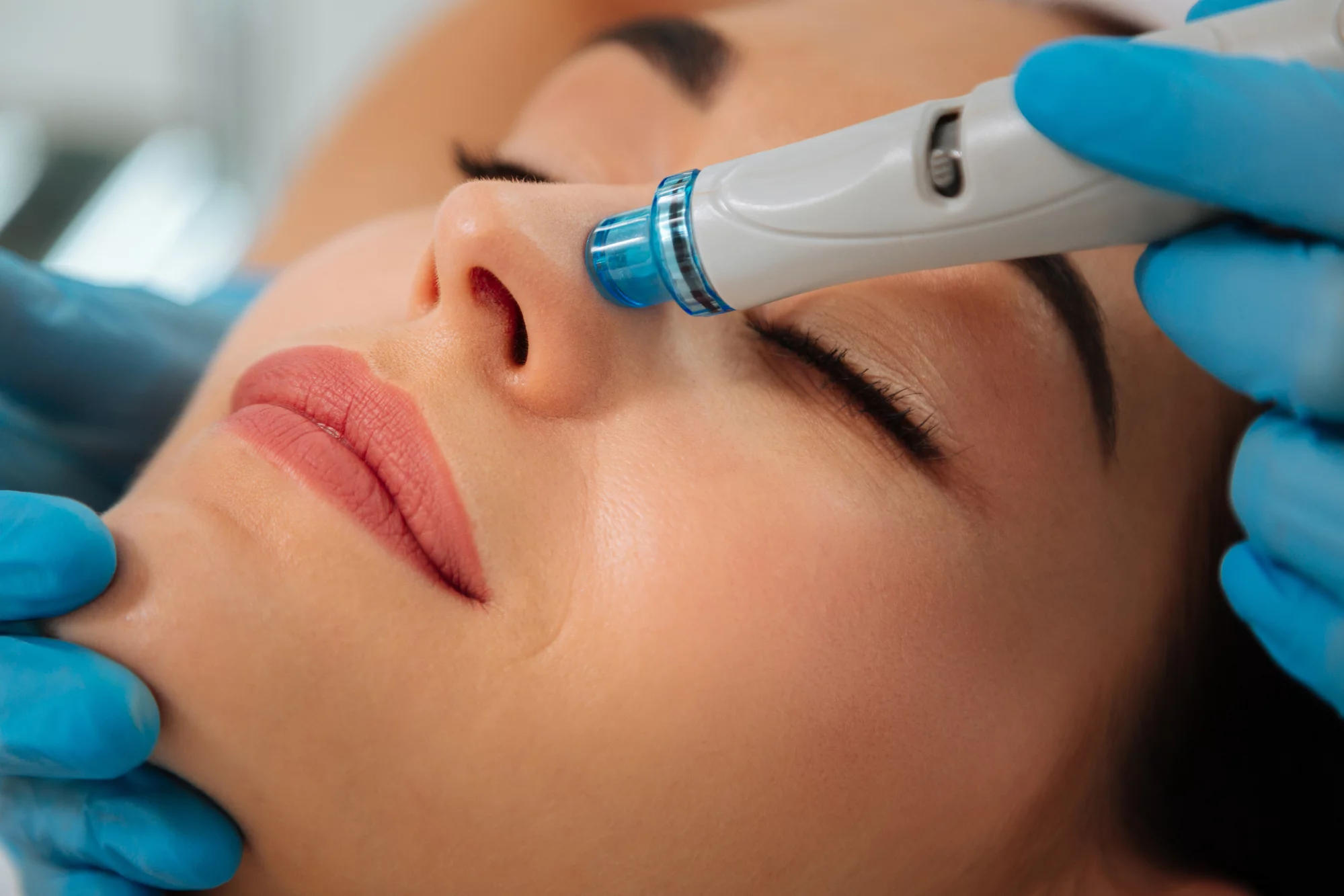 Hydrafacial Treatment: Kulit Glowing Tanpa Ribet!
