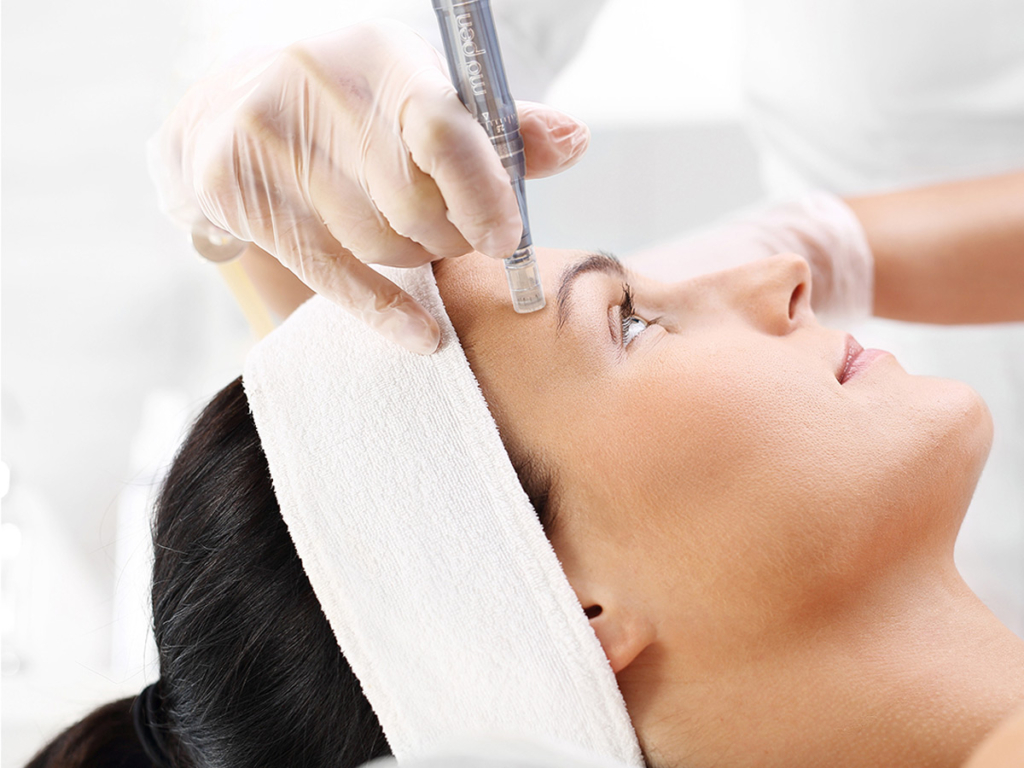 Nano Needling: Perawatan Kulit Cerah Tanpa Rasa Sakit