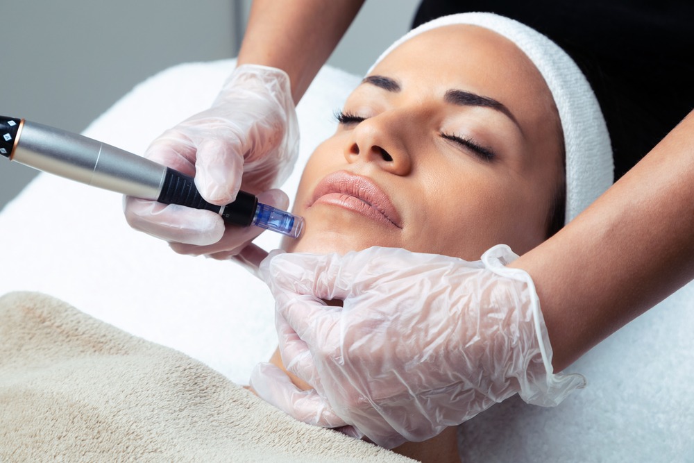 Dermapen Glow
