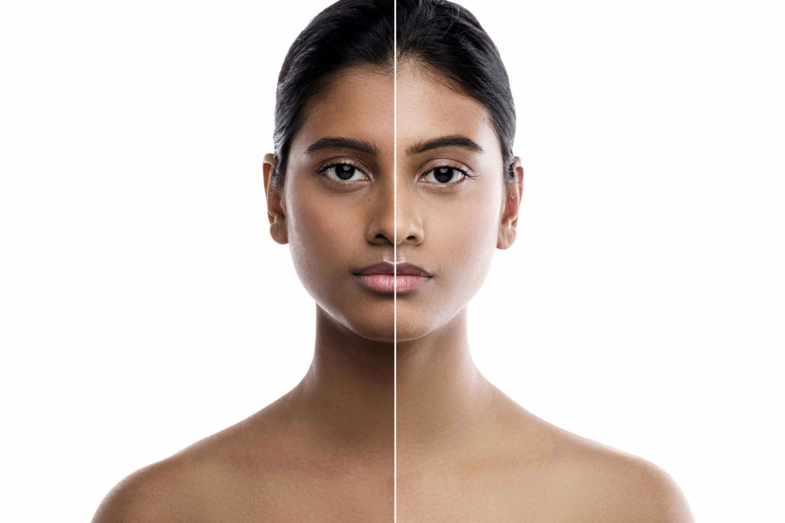 Skin Brightening dengan Vitamin C: Tips dan Manfaatnya