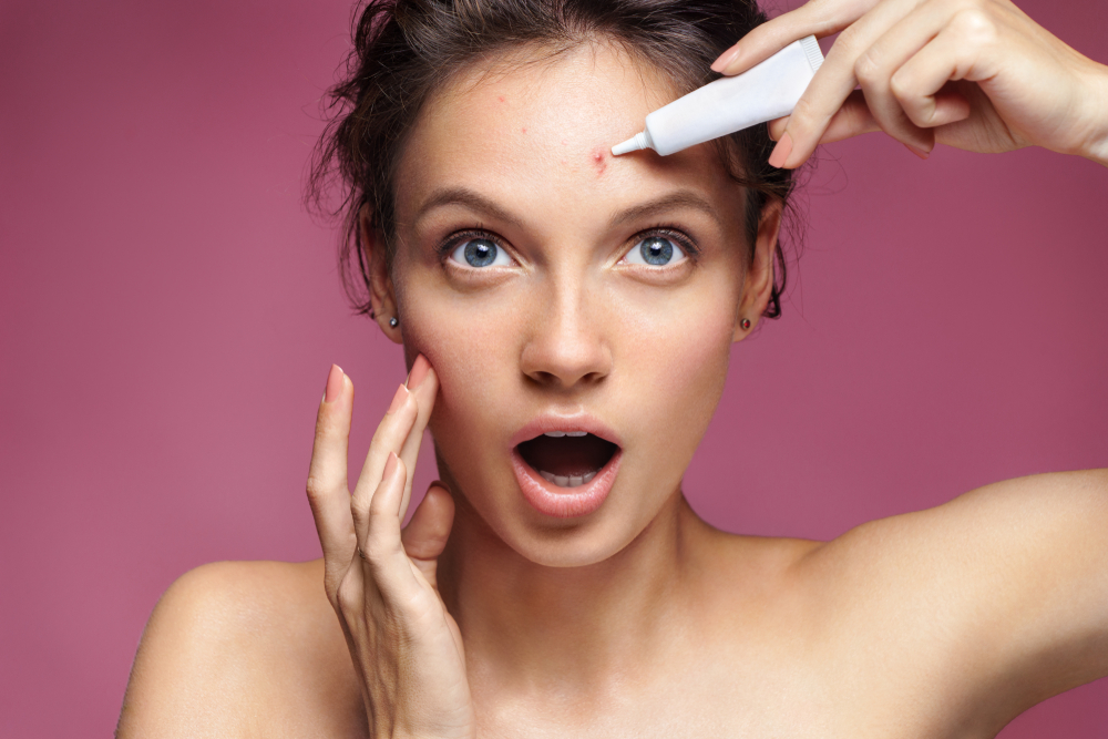 Spot Treatment Terbaik untuk Jerawat Membandel