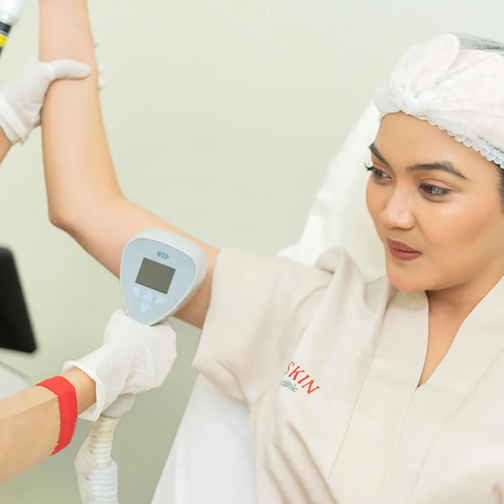 RF Treatment