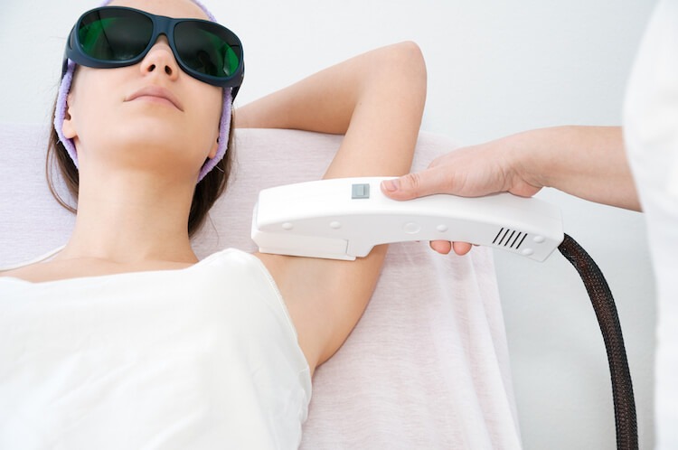 IPL Underarm — Treatment Pain Zero Bikin Ketiak Cerah Alami
