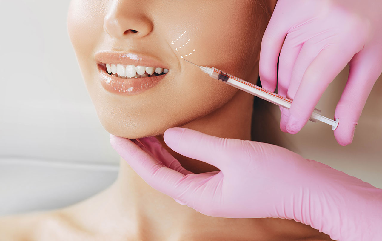 filler injections