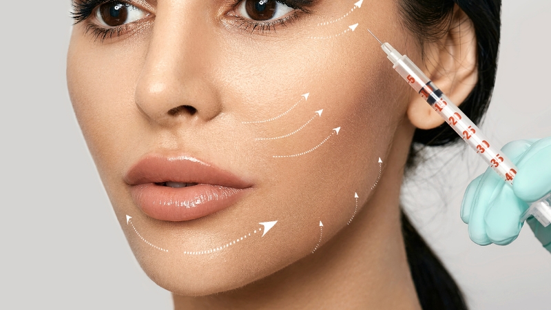 filler injections