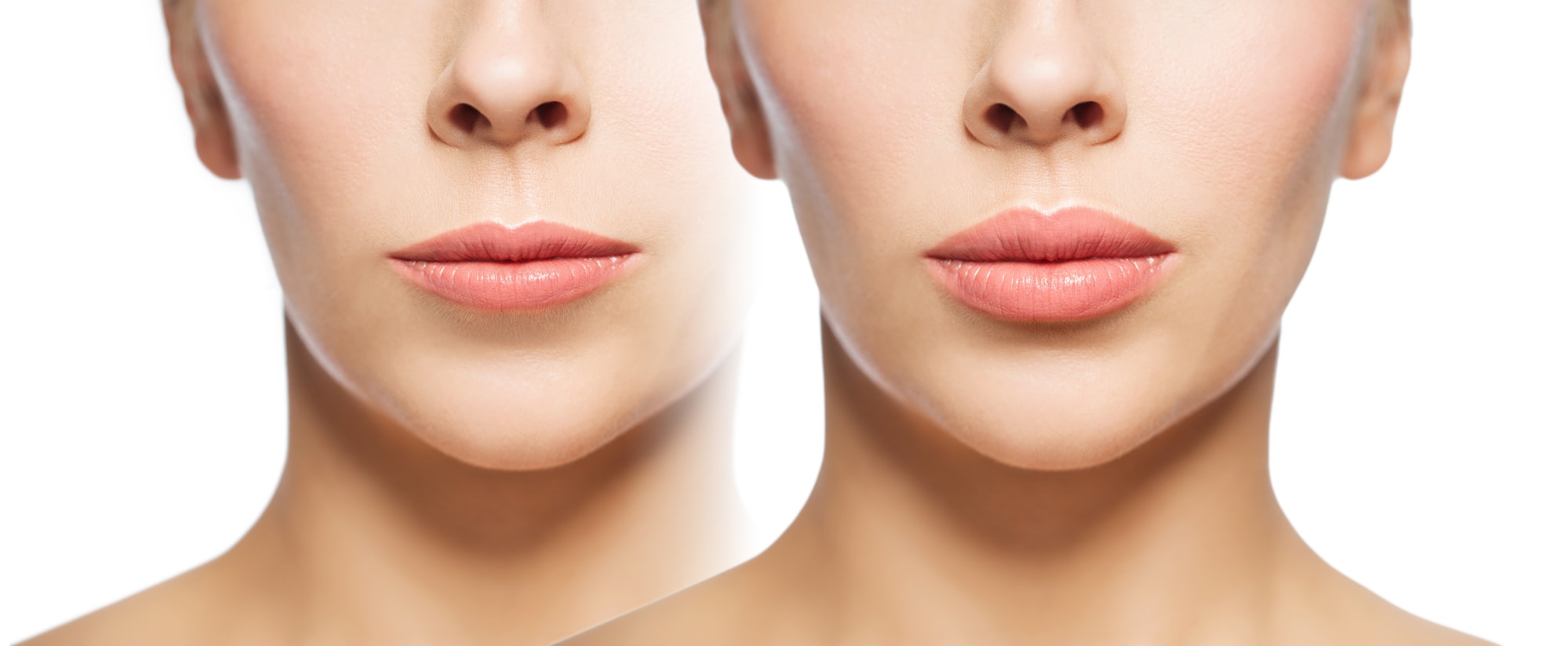 Lip Laser