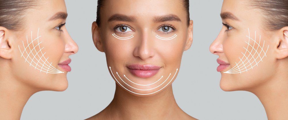 Thread Lift