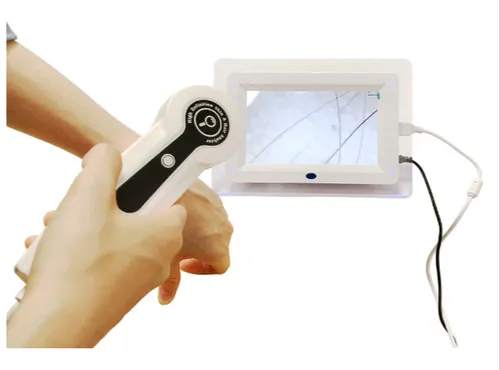 Skin Analyzer Digital: Teknologi Cerdas untuk Mengetahui Kebutuhan Kulitmu