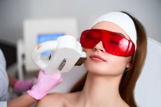 Laser IPL: Treatment Kecantikan yang Bikin Wajah Bebas Noda!