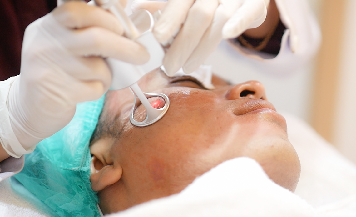 Treatment Hiperpigmentasi