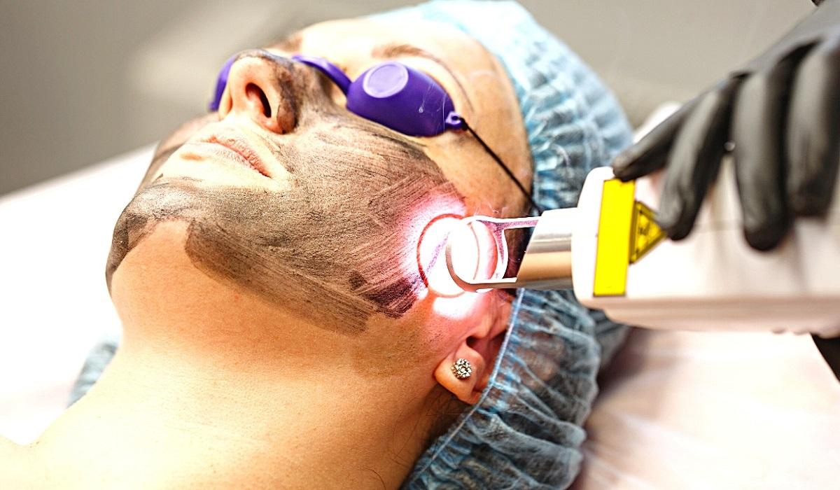 Treatment Hiperpigmentasi: Perawatan Khusus Untuk Kerusakan Kulit Wajah!