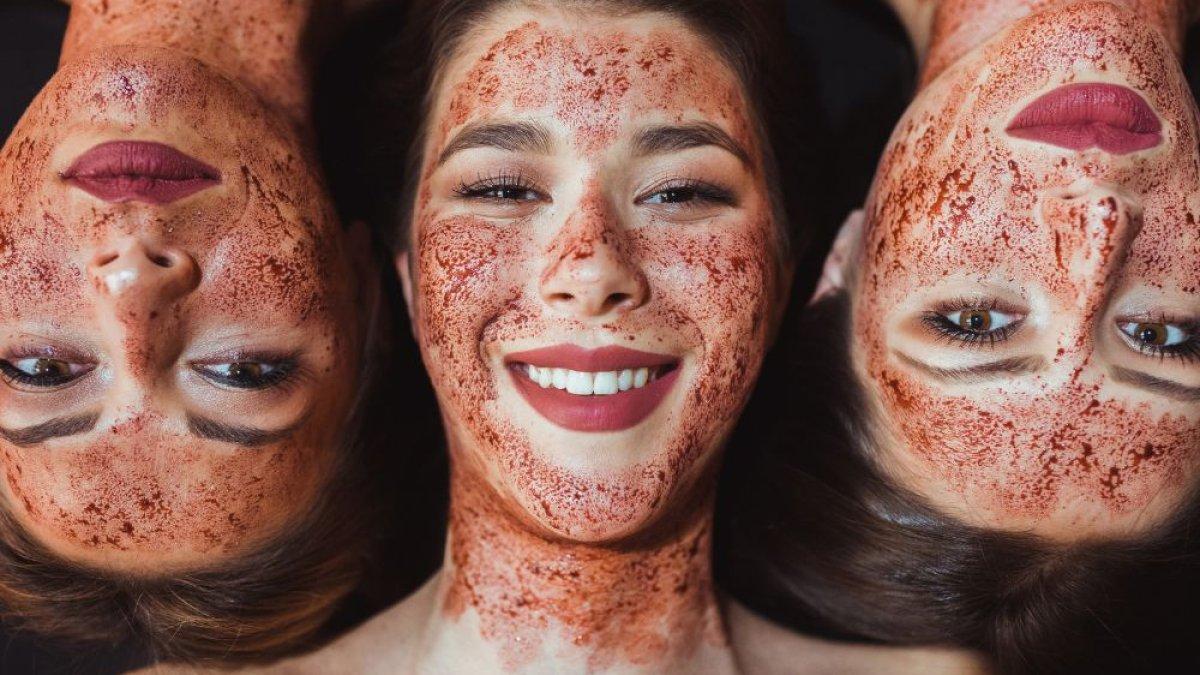 Vampire Facial Perawatan Wajah dengan Darah Sendiri