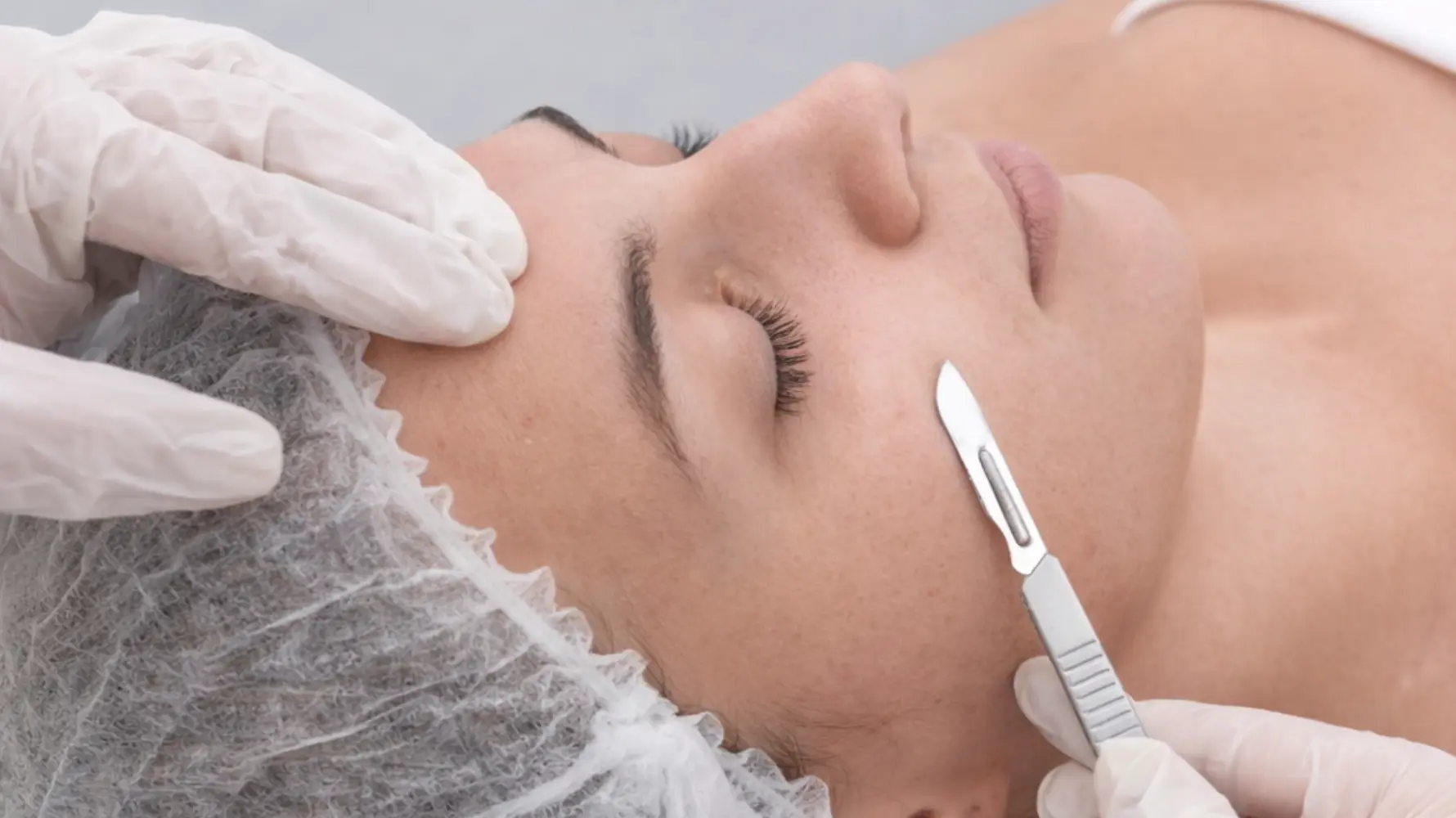 Dermaplaning Eksfoliasi Wajah Halus dan Glowing Seketika