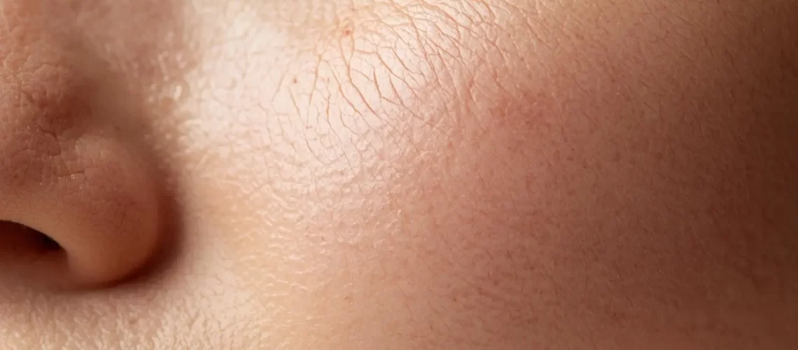 Perawatan Garis Halus