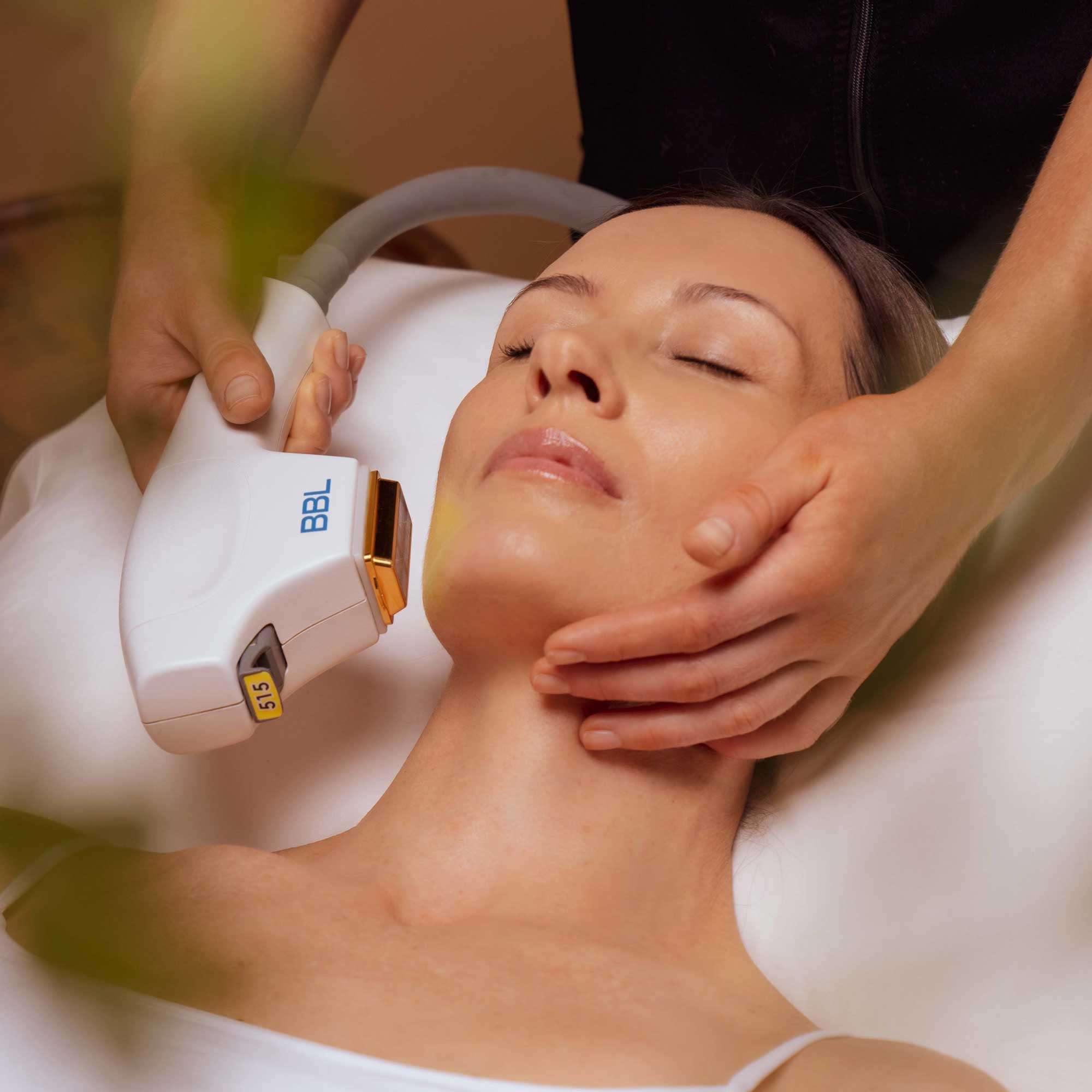 BBL Photofacial Treatment Cahaya untuk Kulit Muda Bersinar – togelon