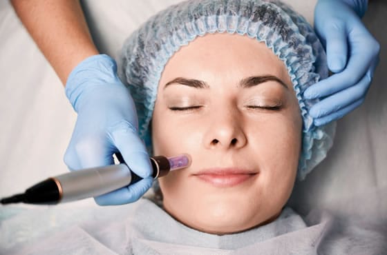 Collagen Therapy untuk Kulit Lebih Kencang dan Awet Muda Secara Alami