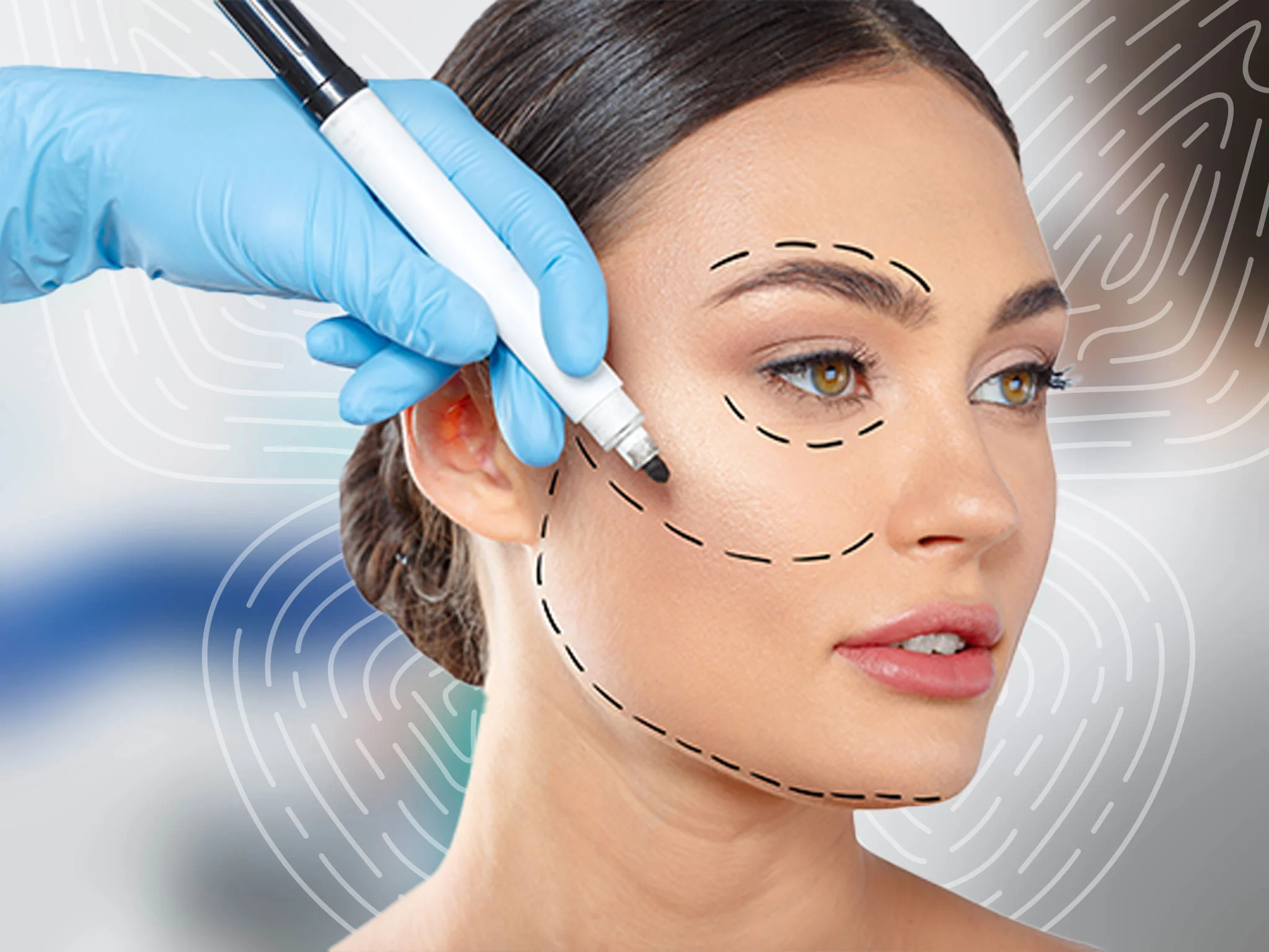 Face Lift: Rahasia Mengencangkan Wajah untuk Tampilan Lebih Muda dan Segar