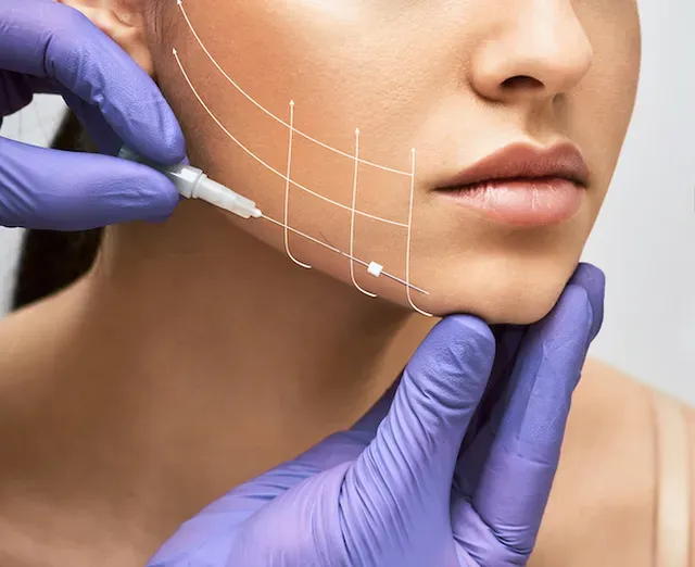 face lift