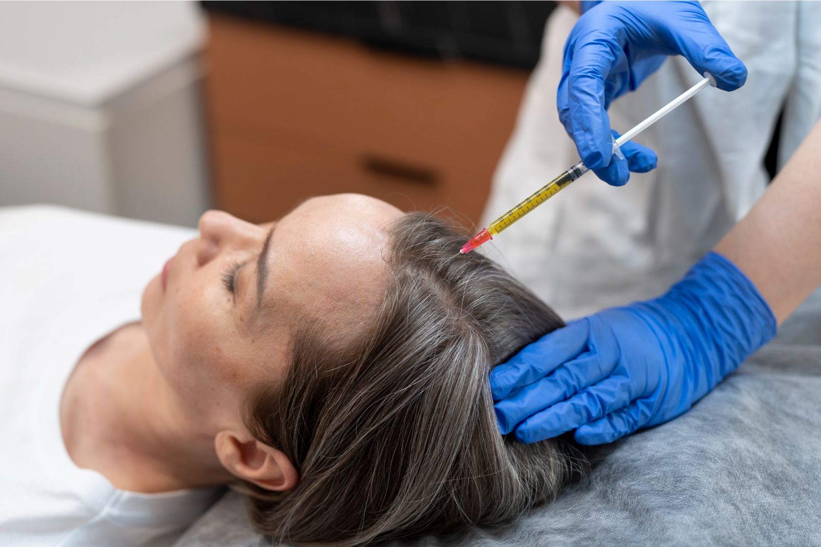 Hair PRP: Solusi Modern untuk Mengatasi Kerontokan dan Menumbuhkan Rambut Lebih Sehat