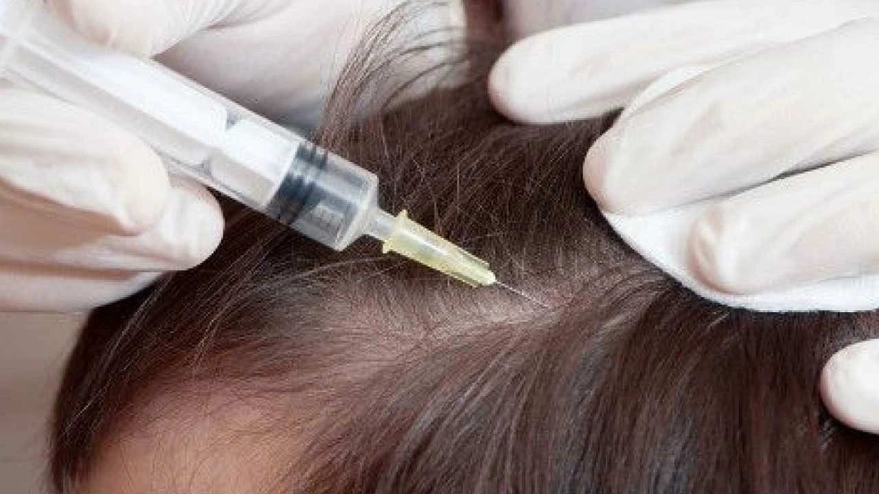 Scalp Injection