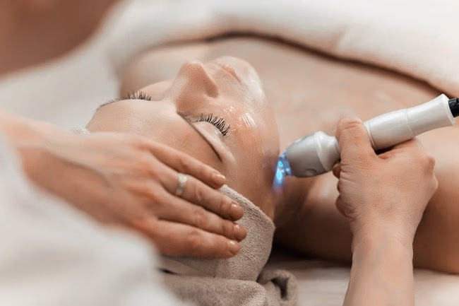 Laser Wajah, Perawatan Modern untuk Kulit Lebih Cerah dan Sehat