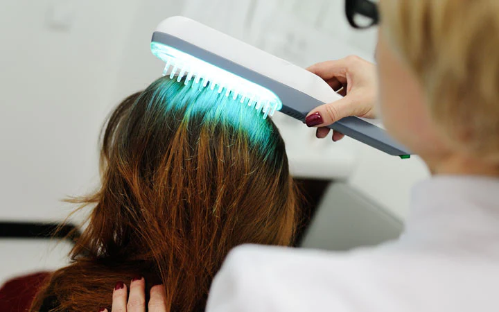 Dandruff Treatment