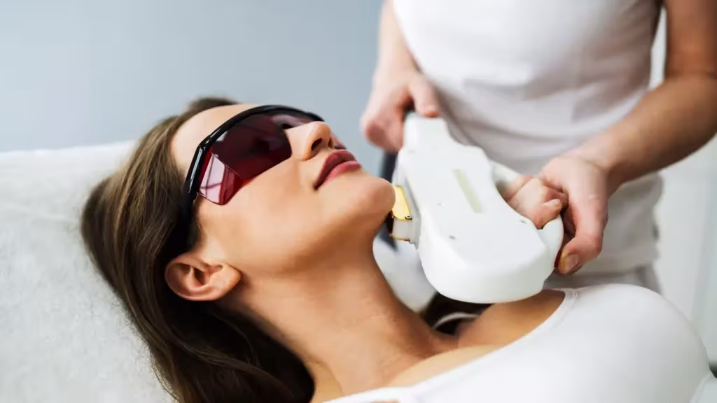 IPL Acne