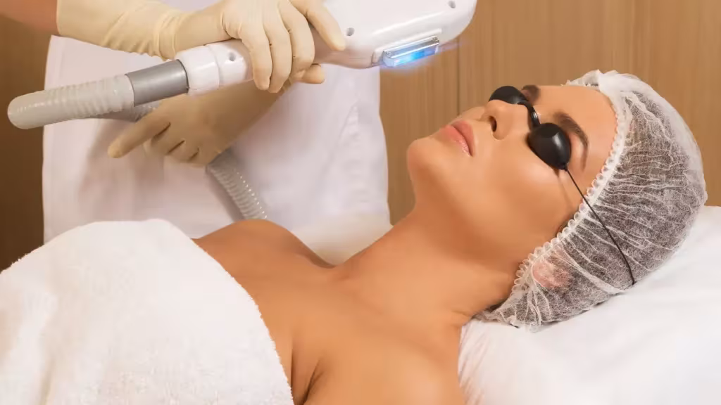 IPL Acne: Perawatan Cahaya untuk Kulit Lebih Bersih dan Terawat