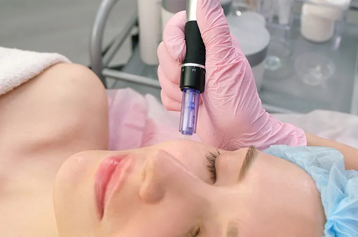 Microneedling Wajah, Rahasia Kulit Lebih Sehat dan Cerah