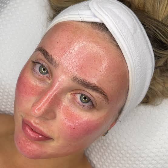 Glass Skin Facial: Perawatan yang Mendukung Tampilan Kulit Sehat dan Bercahaya